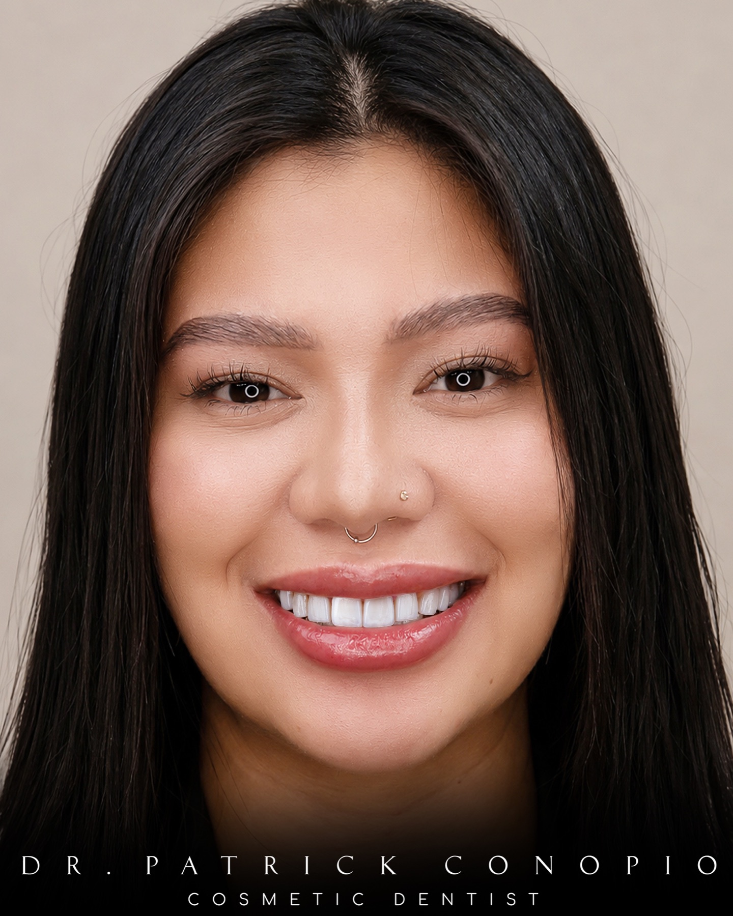 Patient smiling after cosmetic dental care by Dr Patrick Conopio